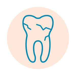 1282419 MintoToothExtractionsIcons 020322 Broken Tooth Icon