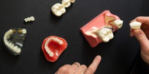 minto oral and maxillofacial surgery fairhope services  6